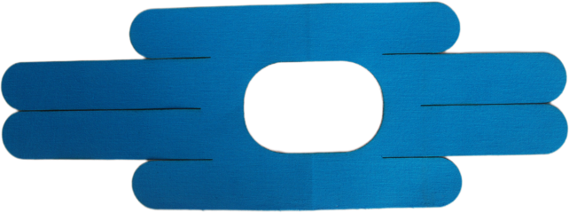 الشريط العضلي