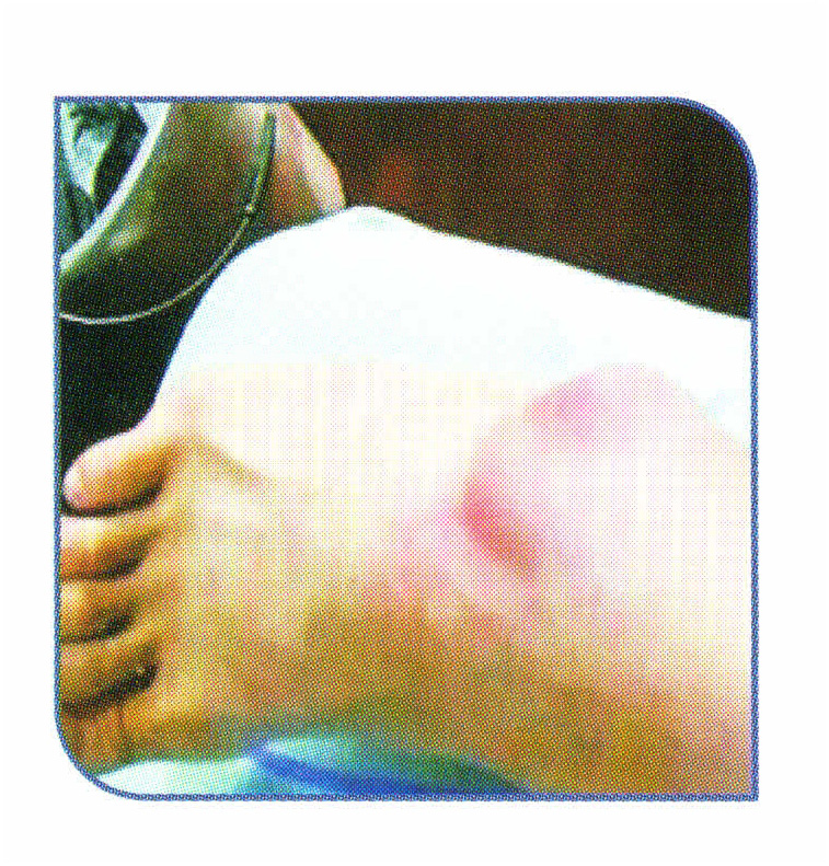 رياضة طبية المنثث بارد بارد ضمادة التبريد للمفصل 7.5 سم &times; 3.6 م